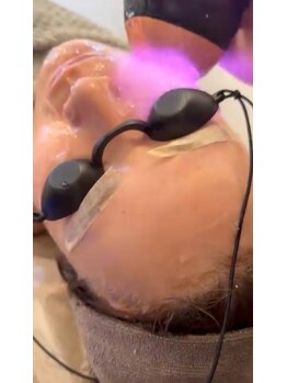 アルページュ(Arpege)/一撃級スッキリ立体小顔＆色白強