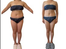 アンドゥ 津田沼(Undo)/痩せないのには理由がある！