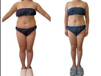 アンドゥ 津田沼(Undo)/痩せないのには理由がある！