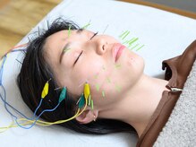 ナギ鍼灸院(nagi鍼灸院)の雰囲気(自分史上最小の小顔になる【美容鍼】)