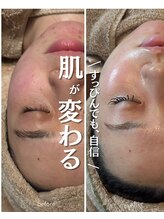 フラーブ(Flourb) ハーブ ピーリング