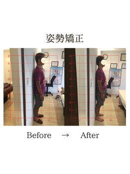 心斎橋長堀フェムテック整骨院/49姿勢矯正　骨格矯正と骨盤矯正