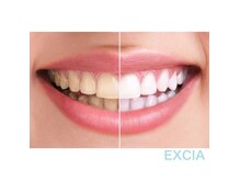 エクシア(EXCIA)の雰囲気（セルフホワイトニング☆痩身&フェイシャルとの併用もオススメ☆）