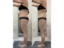 ナルシス/【痩身】12回の変化です★