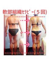 ビューティサロン キヨの部屋(beauty salon)/【軟部組織セラピー】週１回×５