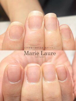 マリーロール 梅田店(Marie Laure)/深爪矯正/自爪育成/自爪風