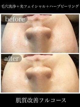 アウラ(AURA)/お肌は応えてくれますね♪