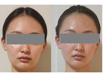 セレブリティ(Celebrity)の写真