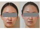 セレブリティ(Celebrity)の写真