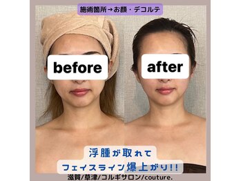 クチュール(couture.)/1回目after