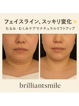 ブリリアントスマイル/与那原サロンレモンボトル