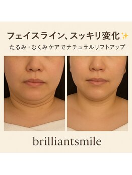 ブリリアントスマイル/与那原サロンレモンボトル