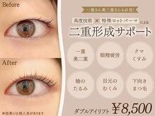 ミーカラー(me calla)の雰囲気(整形なしで二重に導く新技法【ダブルアイリフト】二重幅改善にも)