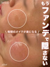 ジェノール 飾磨本店(JNOEL)/もうファンデで隠さない！