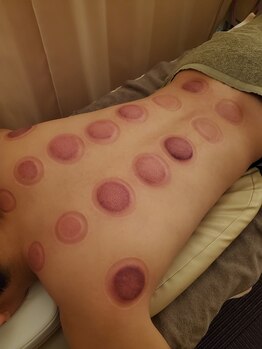 イズミ整骨院 大泉院/