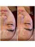 【学割U24】｜小顔になりたい　インディバフェイシャル　40分　¥10000→