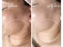 ルポ 鶴見(Repos)/シュっとした輪郭に★小顔ケア