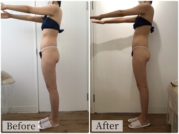 ボーレーヴ(beau reve)/ブライダル/インディバ/痩身