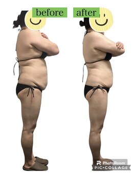 トータルケアーサロン アクア 時津(AQUA)/ダイエット：ビフォーアフター