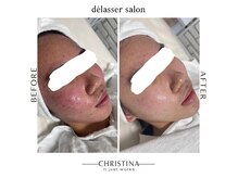 デラッセ サロン ギンザ 藤枝店(Delasser salon GINZA)の雰囲気（結果重視のクリスティーナフェイシャル（約3ヶ月））