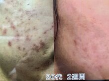 ドゥースモモ(DOUCE momo)の雰囲気（長年悩んだニキビケアや跡もお任せ！短期間で結果が分かります◎）