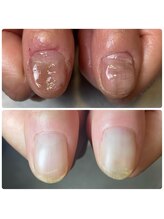 コルザ(COLZA)/ネイルケア