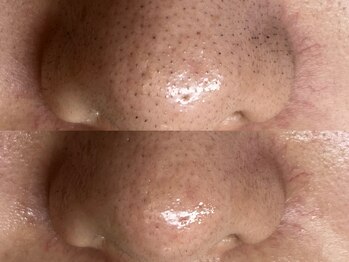 フレーズ(fraise)/