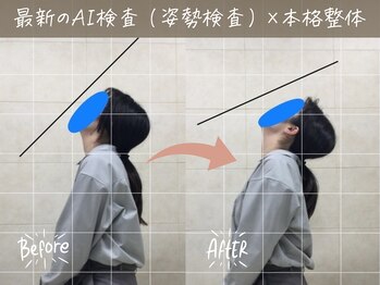 ナオル整体 町田院(NAORU整体)/before/after【9】 町田/整体