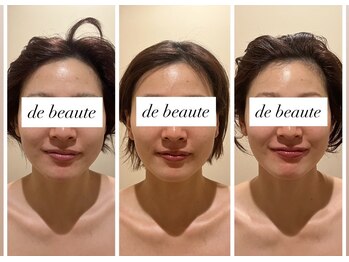 ドゥ ボーテ(de beaute)/垢抜けフェイスライン♪