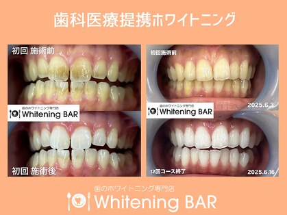 ホワイトニングバー 新潟店の写真