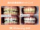 ホワイトニングバー 新潟店の写真