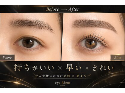アイリズム(eye.Rizm)の写真