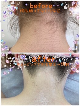 ビューティサロン ココモ(Cocomo)/うなじ脱毛