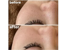 メナードフェイシャルサロン 岐阜茜部/スムースジェルパック