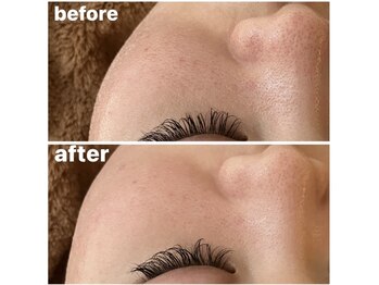 メナードフェイシャルサロン 岐阜茜部/スムースジェルパック