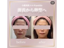 小顔美肌コルギ専門店 センティード 吉祥寺(Sentido)/