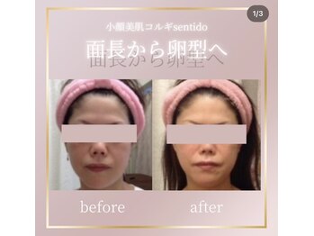 小顔美肌コルギ専門店 センティード 吉祥寺(Sentido)/