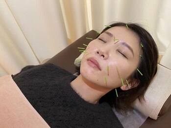 アリス鍼灸整骨院/美容鍼