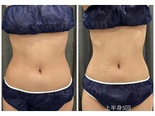 アエ メゾン(ae maison)/上半身5回後