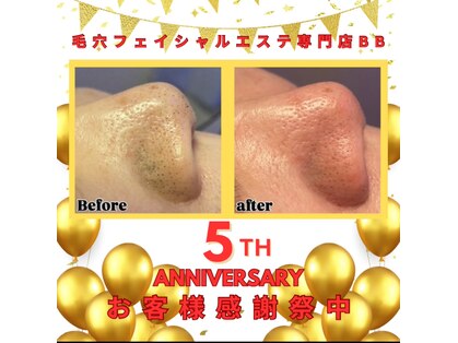 ビービー(BB)の写真
