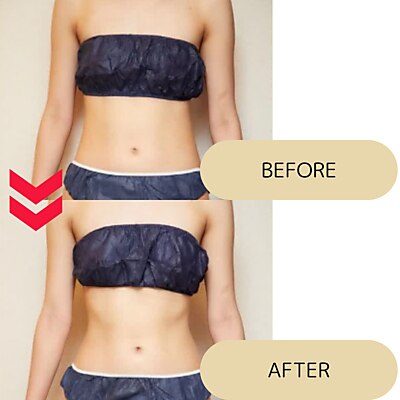 ★ サロン専売品　痩身ジェルお値下げ！！ エムジェル Lien フォールアイシングジェル Z107(Z107): コスメ