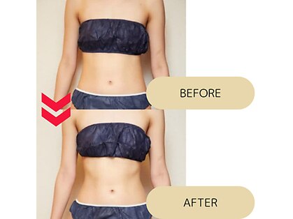 ビューティーサロン セガール(segar)の写真