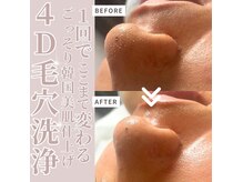 ジェモ(Jemo)の雰囲気（ピーリング作用のあるで角栓を浮かしその浮いた汚れや角栓を吸引）