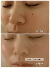 ココナチュレ(coconature)/透明感アップ発泡炭酸洗顔