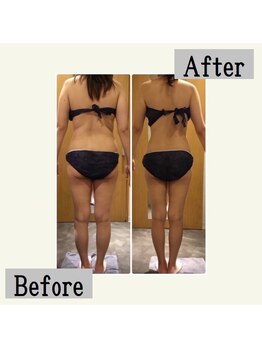 ペールノエル 富士店(PERENOEL)/サーモ,インディバetc(30代女性)