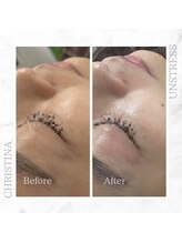 シャルムパリス(charme paris)/潤い持続♪１回の施術変化