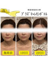 トリニティスペース(TrinitySpace)/レモンボトルビフォーアフター