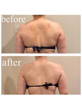 ディス イズ ミー エステティック(This is Me Aesthetic)/本気deダイエット