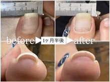 カラダセラピー アイズアンドジュエリーネイル(eye’s&Jewelry Nail)の雰囲気（【最新】韓国で特許取得済みの特殊ジェルで巻き爪ケア）