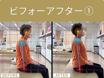 市川さくら整体院/ビフォーアフター１